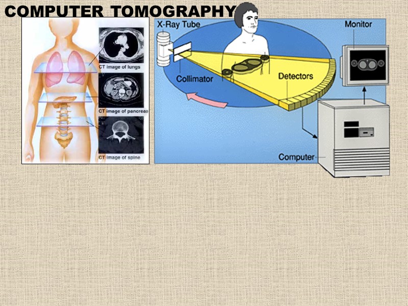 COMPUTER TOMOGRAPHY